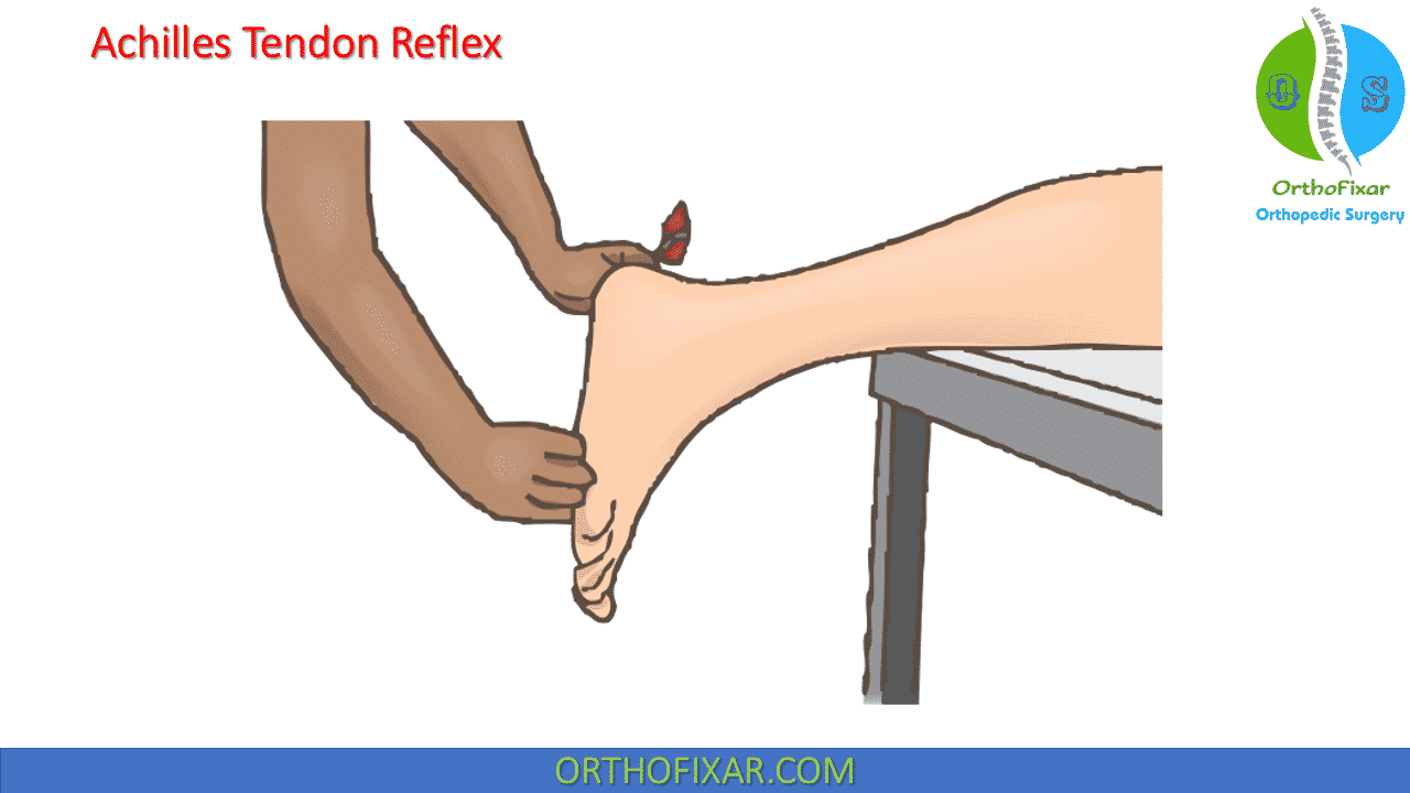 Achilles Reflex Test OrthoFixar 2024