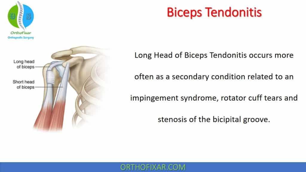 Biceps Reflex Test Orthofixar