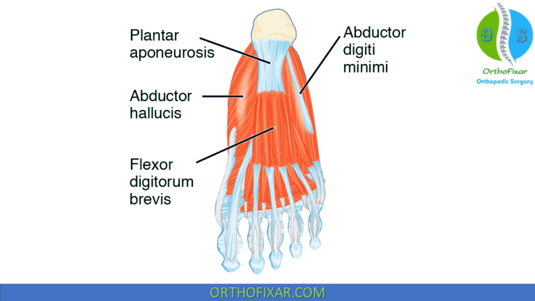 Plantar Fasciitis Injection OrthoFixar 2024