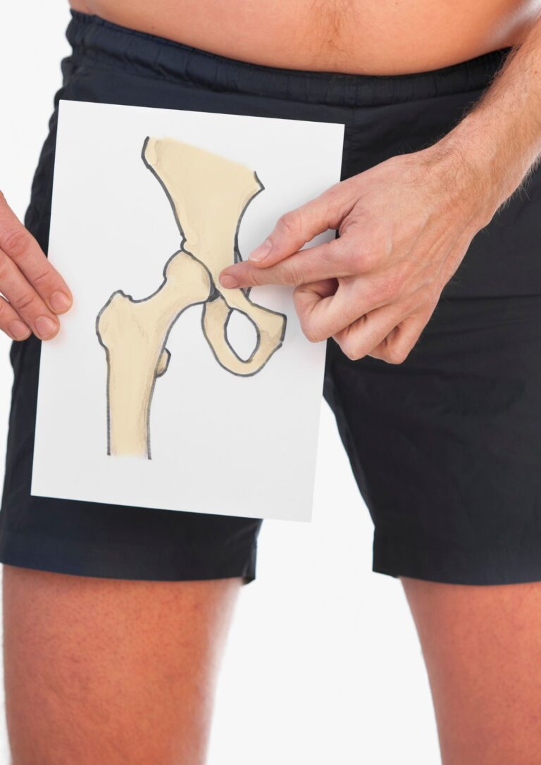 Hip Rim Hip Joint Anatomy: Acetabulum, Proximal Femur, Capsule & Ligaments