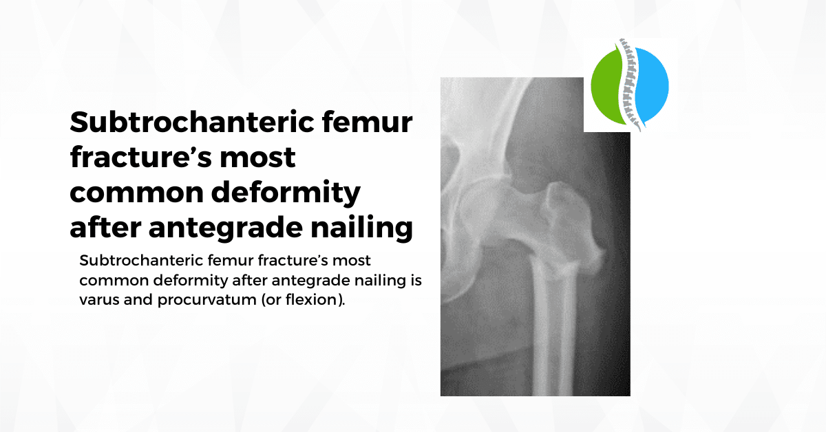 Subtrochanteric Femur Fractures Deformity