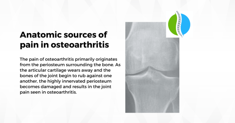 pain in osteoarthritis disease