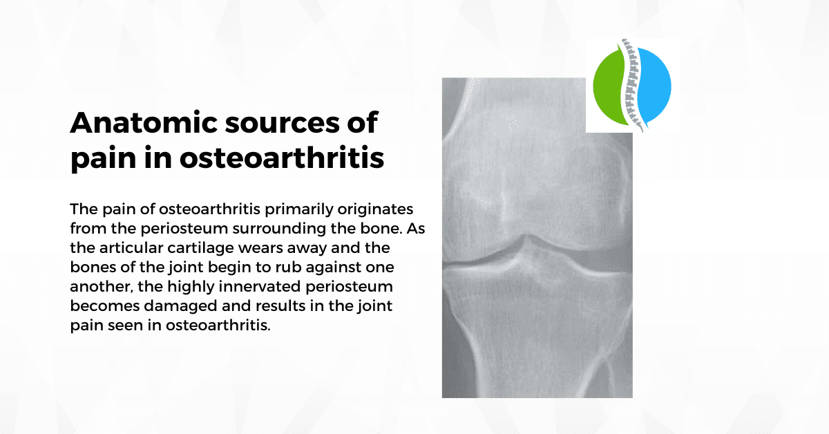 Anatomic sources of pain in osteoarthritis
