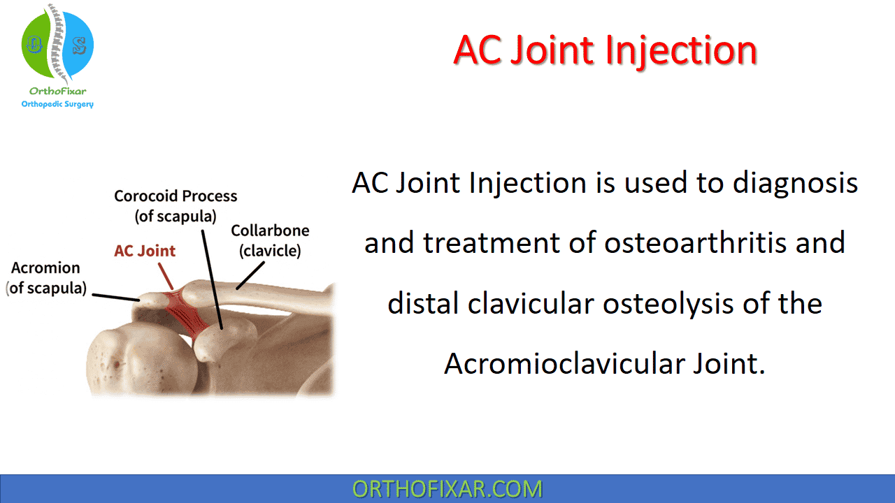  AC Joint Injection 