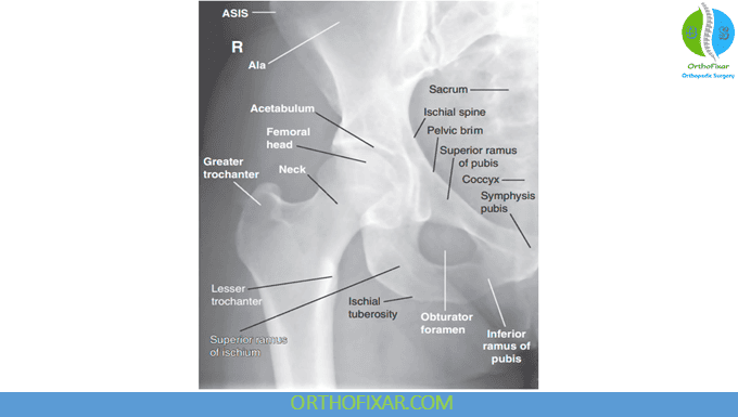 Hip Joint X-Ray Imaging 1 AP Hip X-Ray