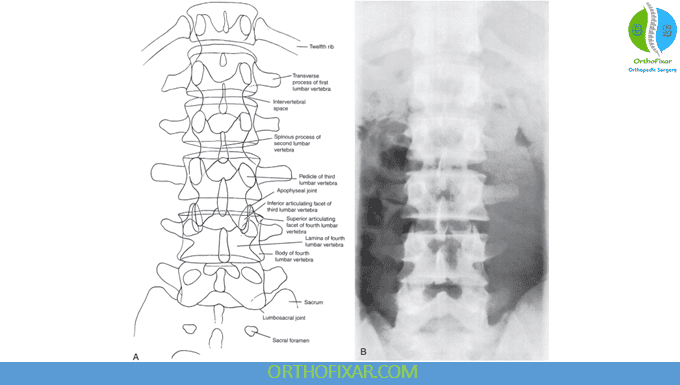 Lumbar Spine X-Ray Views 1 AP lumbar vertebrae X-ray