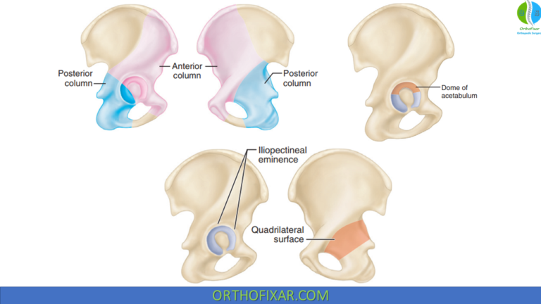 Acetabulum Fracture: Anatomy, Classification, And Treatment