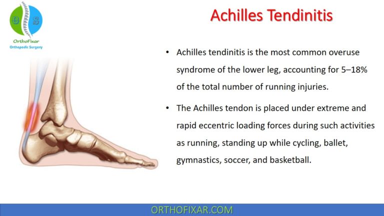 Achilles Tendinitis
