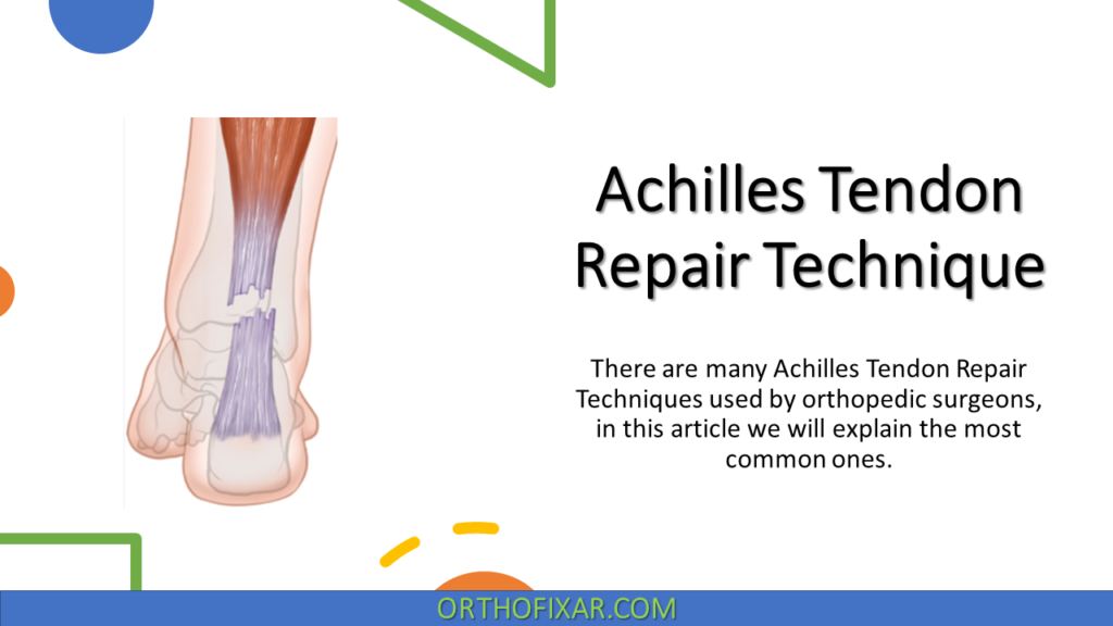 Achilles Tendon Repair Techniques: Steps, Krackow & Lindholm Methods