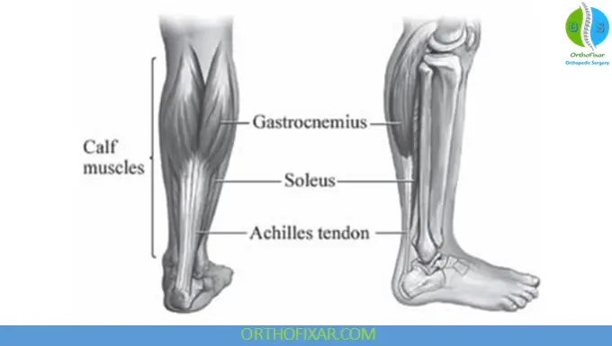 Achilles Tendon