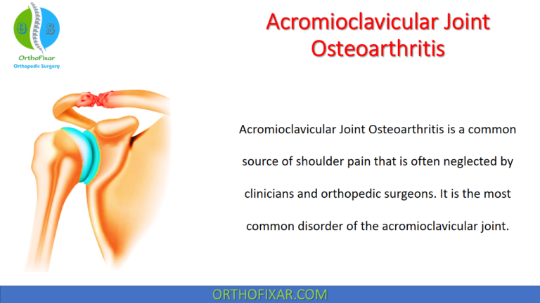 Acromioclavicular Joint Osteoarthritis