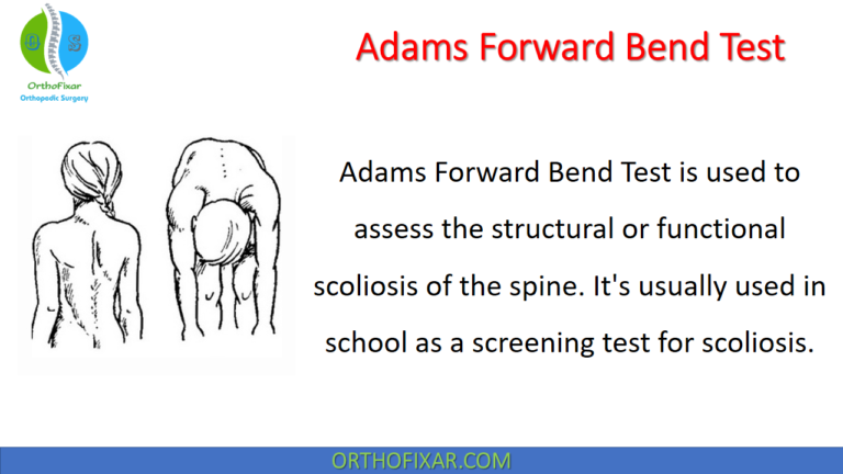 Adams Forward Bend Test