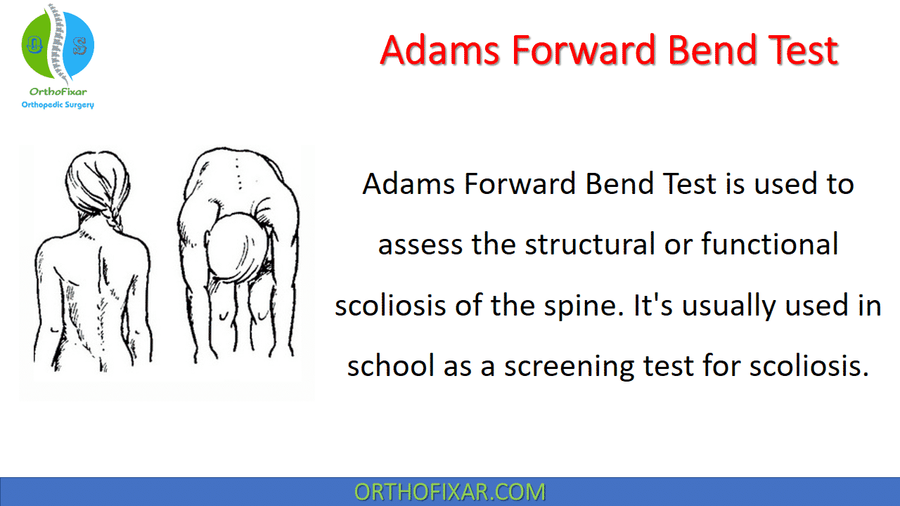  Adams Forward Bend Test 