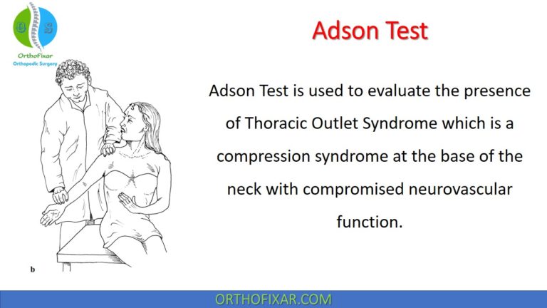 Adson Test