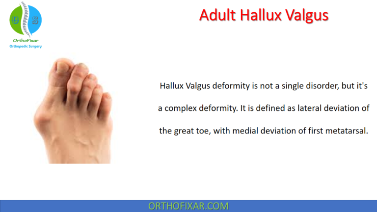 Adult Hallux Valgus deformity