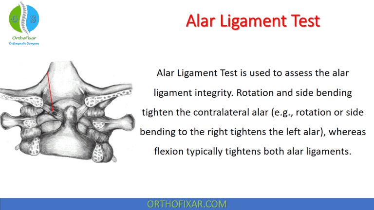 Alar Ligament Test
