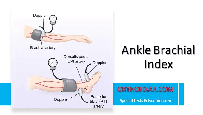 Ankle Brachial Index