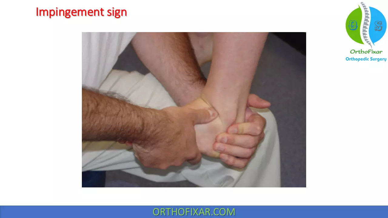 Ankle Impingement sign - Dorsiflexion