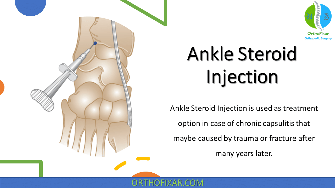 Ankle Steroid Injection
