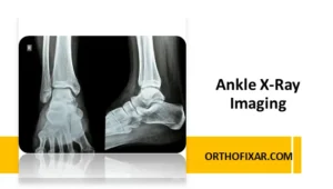 Ankle X Ray Imaging