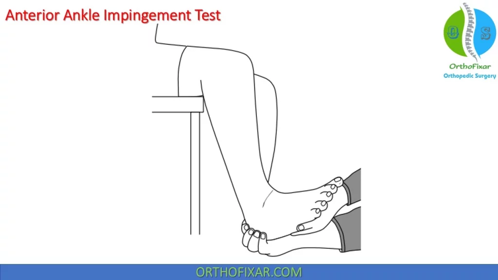 Anterior Ankle Impingement Test