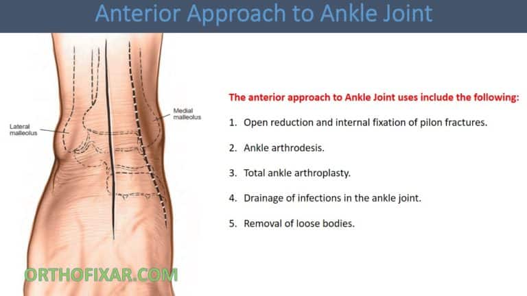 Anterior Approach to Ankle Joint
