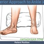 Anterior Approach To Ankle Joint - OrthoFixar 2021