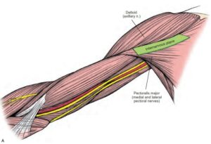 Anterior Approach To Humerus Shaft | OrthoFixar 2024