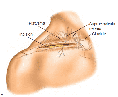 clavical