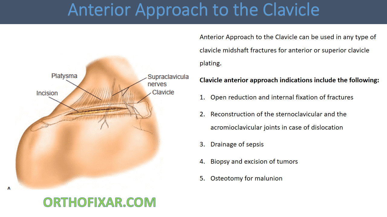 Anterior Approach to the Clavicle