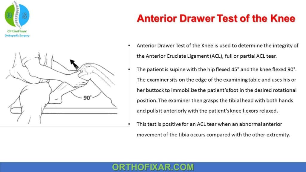 Anterior Drawer Test Of The Knee | OrthoFixar 2024