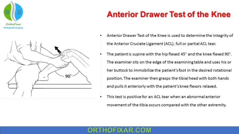 Anterior Drawer Test of the Knee