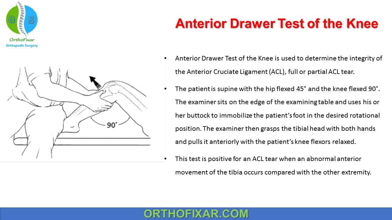  Anterior Drawer Test of the Knee 