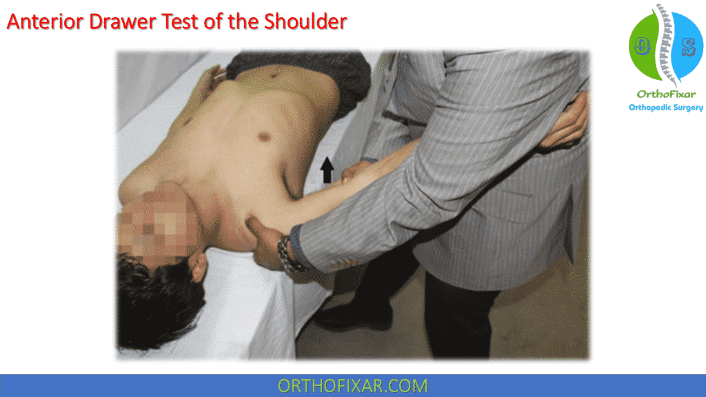 Anterior Drawer Test of the Shoulder