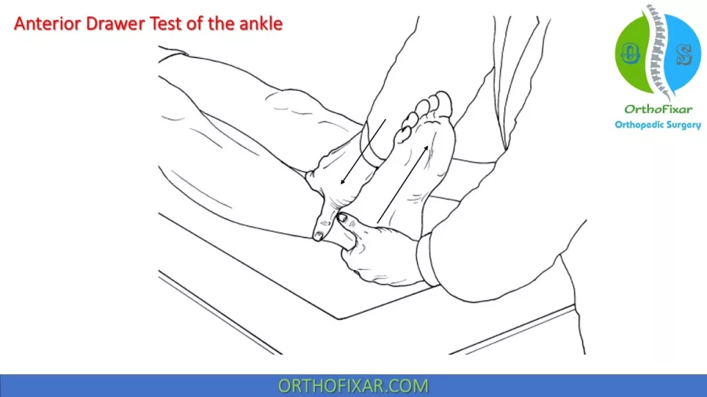 Ankle Anterior Drawer Test