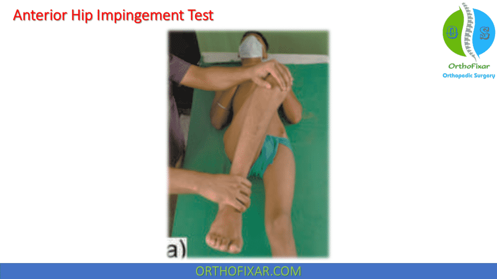 Anterior Hip Impingement Test