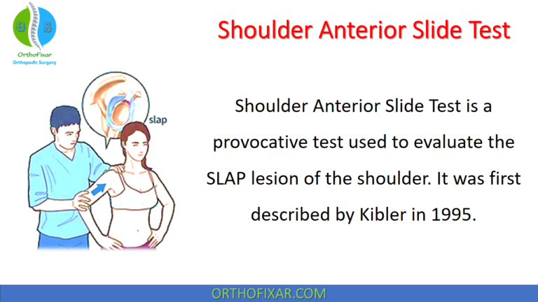 Anterior Slide Test