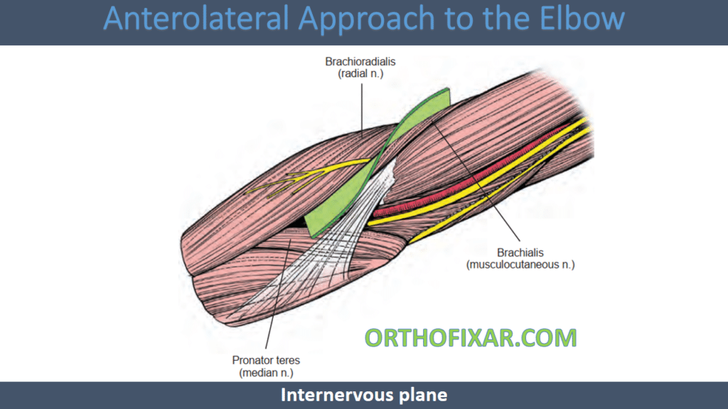 Anterolateral Approach to the Elbow