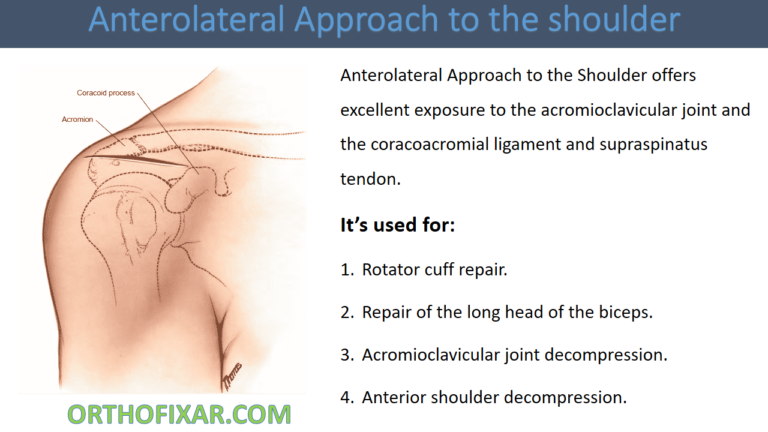 Anterolateral Approach to the shoulder