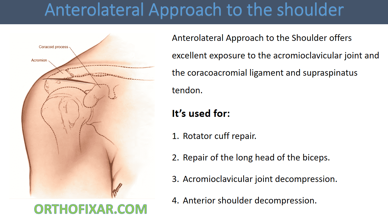 Anterolateral Approach to the Shoulder