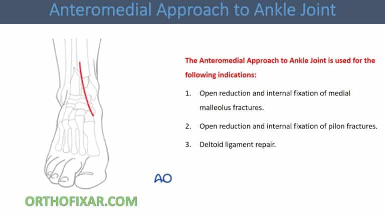 Anteromedial Approach to Ankle Joint