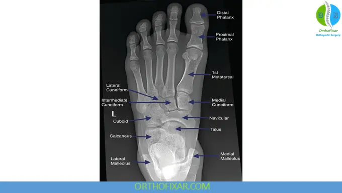 Anteroposterior View of the Foot