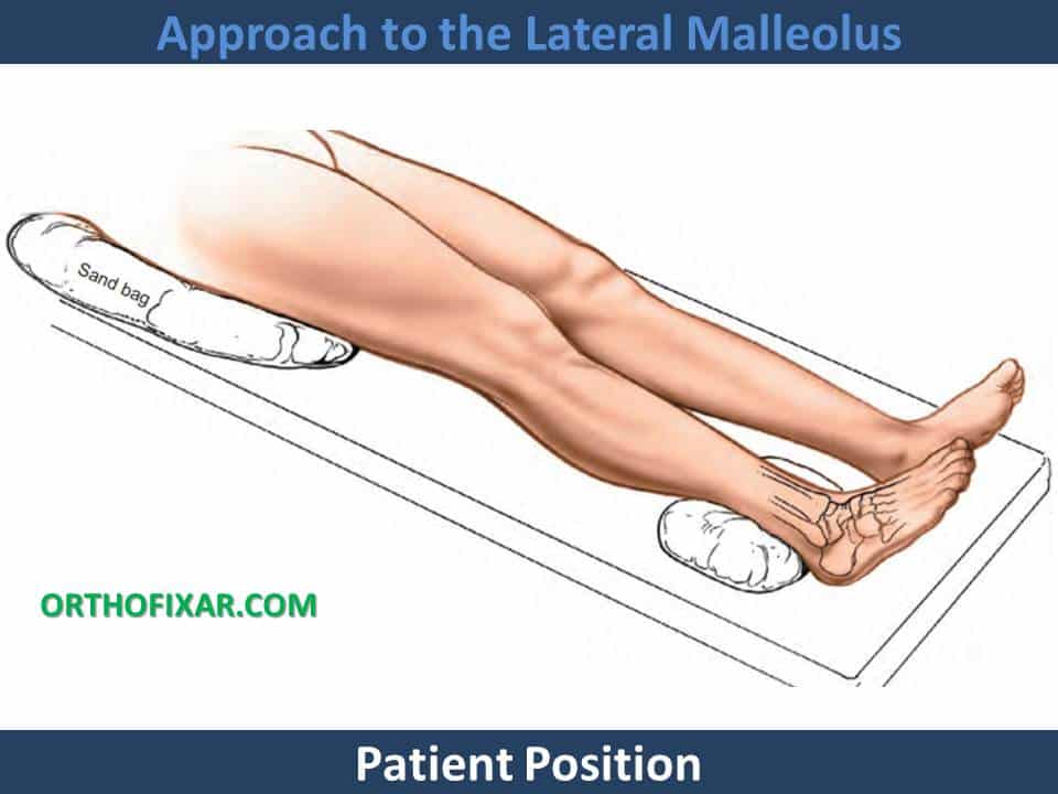 Approach to the Lateral Malleolus