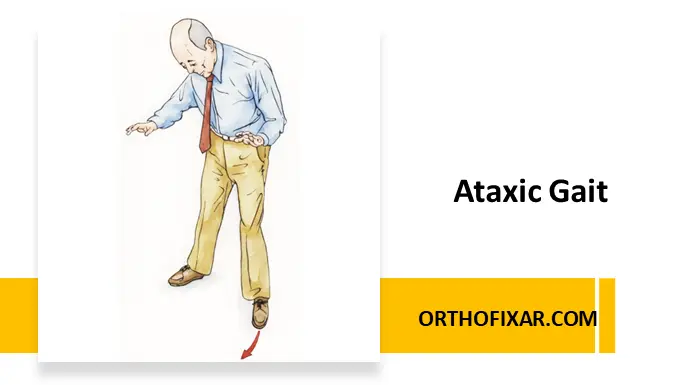 Ataxic Gait
