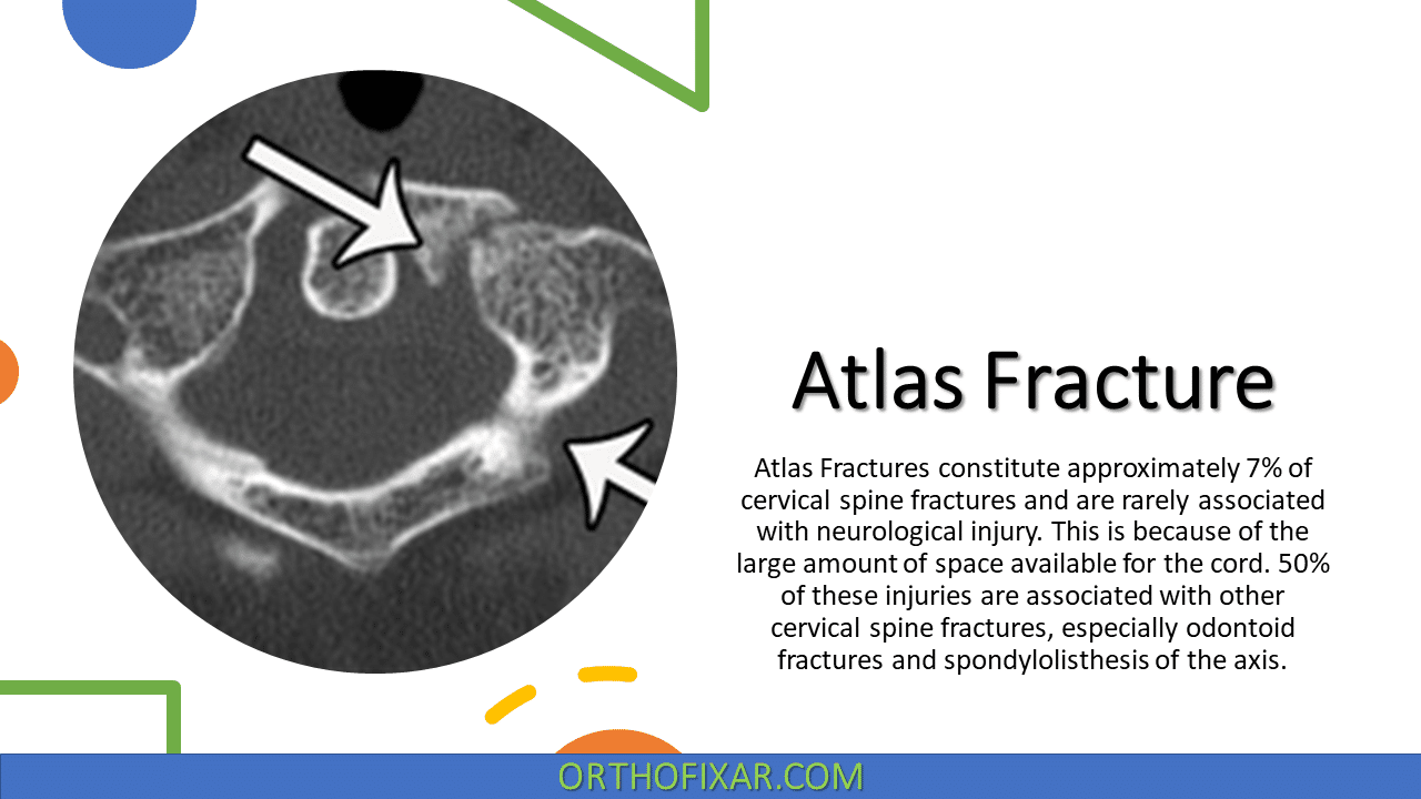  Atlas Fracture | Diagnosis, Classification & Treatment 