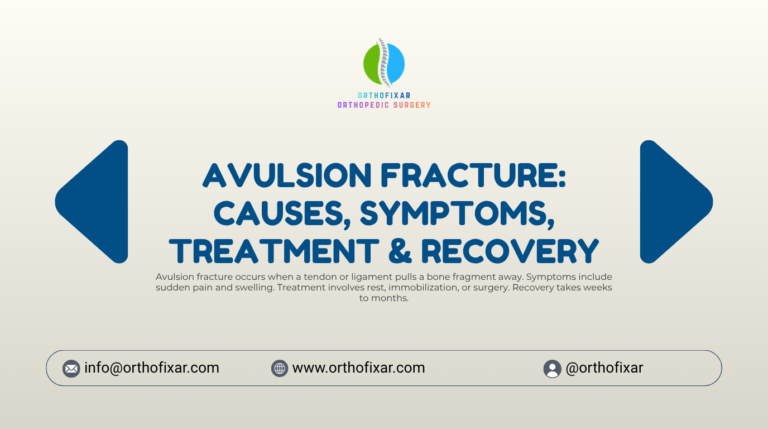 avulsion fracture