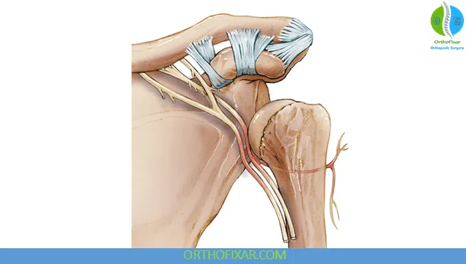 Axillary Nerve compression during shoulder dislocation