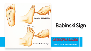 Babinski Test