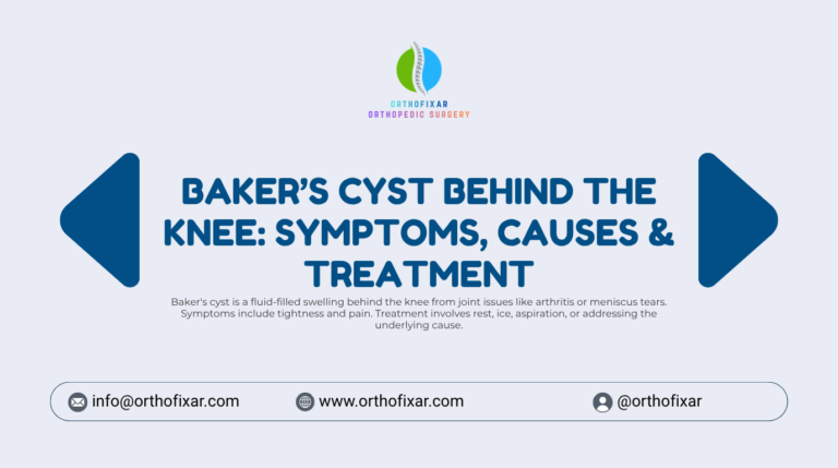 Baker's cyst