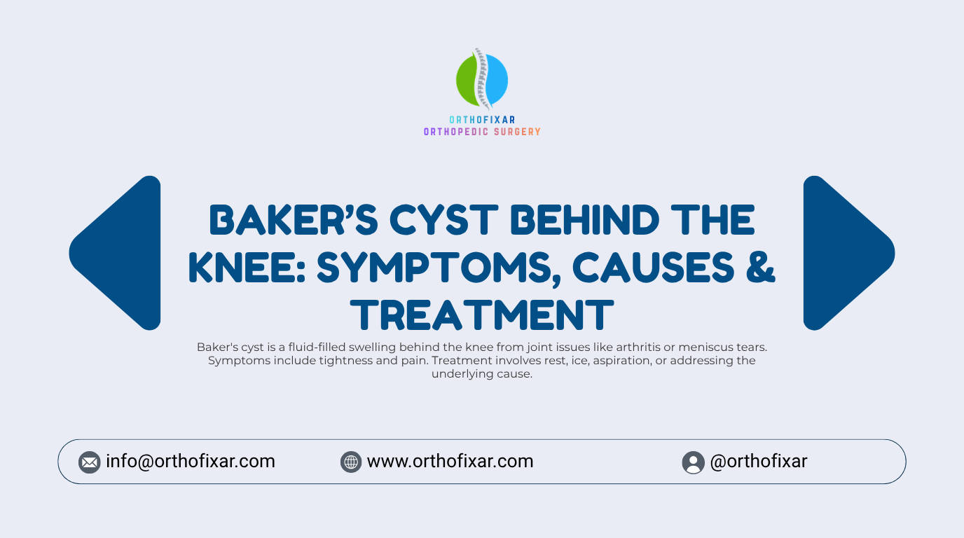 Baker's cyst